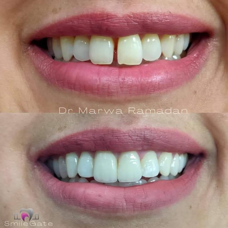 دكتورة مروة محمد رمضان  اخصائى طب وجراحة الفم و تجميل الاسنان