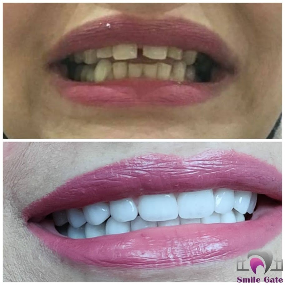دكتورة مروة محمد رمضان  اخصائى طب وجراحة الفم و تجميل الاسنان
