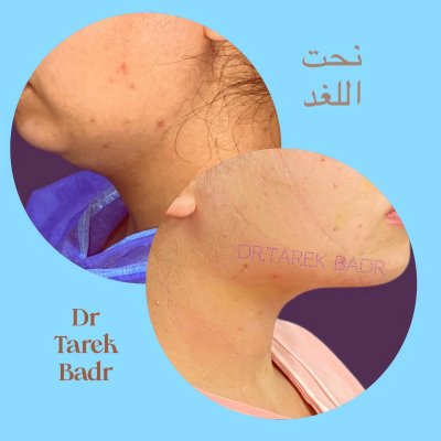 دكتور طارق محمد بدر إستشاري جراحة التجميل وتنسيق القوام