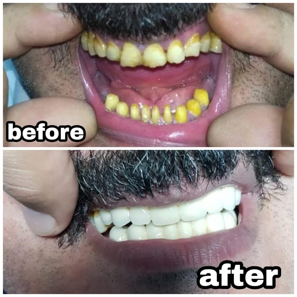 smile up dental care دكتور أحمد السيد رجب أخصائى طب وجراحة الفم والأسنان