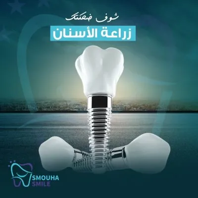 مركز سموحة سمايل smouha smile للاسنان