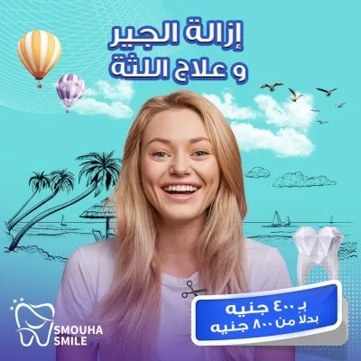 مركز سموحة سمايل smouha smile للاسنان