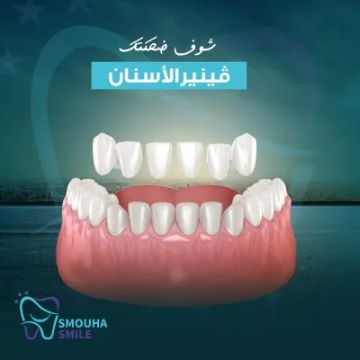 مركز سموحة سمايل smouha smile للاسنان