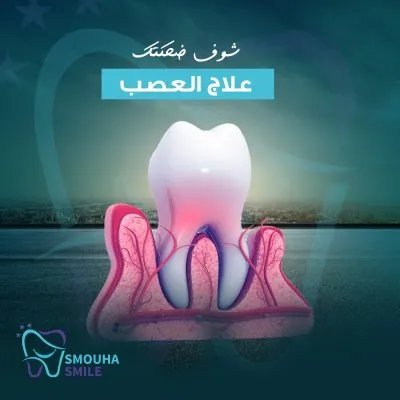 مركز سموحة سمايل smouha smile للاسنان