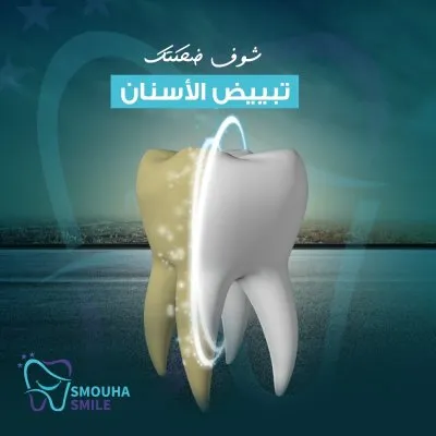 مركز سموحة سمايل smouha smile للاسنان