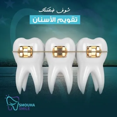مركز سموحة سمايل smouha smile للاسنان