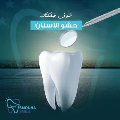 مركز سموحة سمايل smouha smile للاسنان