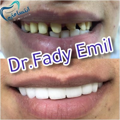ابتسامتى لتقويم وتجميل الاسنان  دكتور فادى اميل EBTESAMTY Dental Clinic