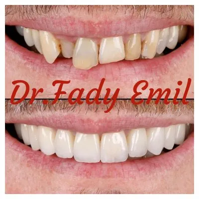 ابتسامتى لتقويم وتجميل الاسنان  دكتور فادى اميل EBTESAMTY Dental Clinic
