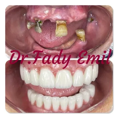 ابتسامتى لتقويم وتجميل الاسنان  دكتور فادى اميل EBTESAMTY Dental Clinic