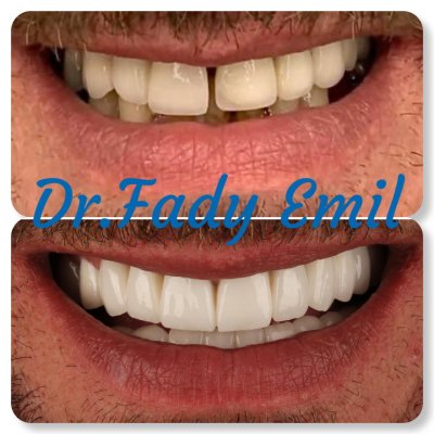 ابتسامتى لتقويم وتجميل الاسنان  دكتور فادى اميل EBTESAMTY Dental Clinic