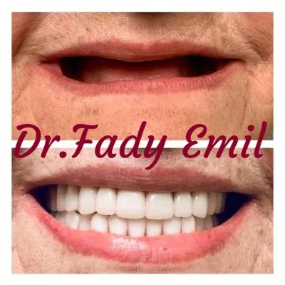 ابتسامتى لتقويم وتجميل الاسنان  دكتور فادى اميل EBTESAMTY Dental Clinic