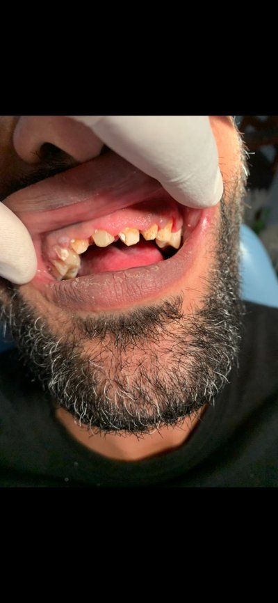 مركز A Star Dental Center دكتور محمد نبيل بسيونى لطب الأسنان
