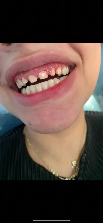 مركز A Star Dental Center دكتور محمد نبيل بسيونى لطب الأسنان