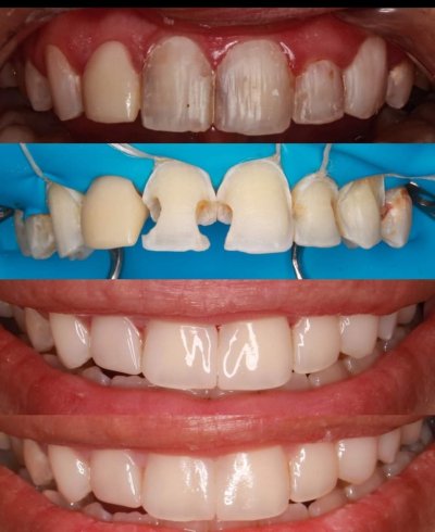 مركز رمادا لطب الفم و الأسنان