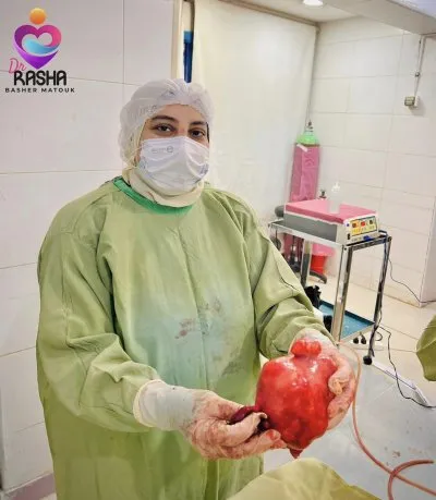 دكتورة رشا بشير معتوق استشاري النساء و التوليد و الحقن المجهري