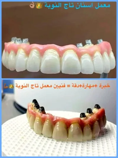 معمل اسنان تاج النوبة