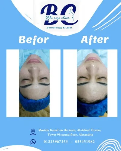 عيادة بلو كير للجلدية والتجميل والليزر  Blu Care Clinic