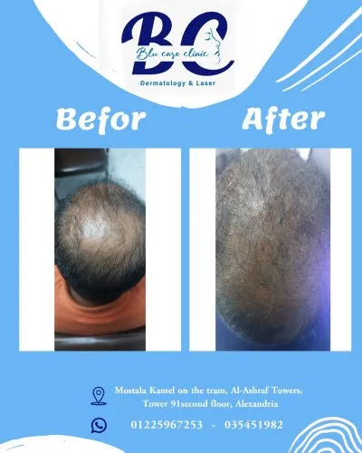عيادة بلو كير للجلدية والتجميل والليزر  Blu Care Clinic