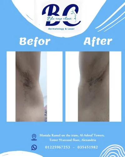 عيادة بلو كير للجلدية والتجميل والليزر  Blu Care Clinic