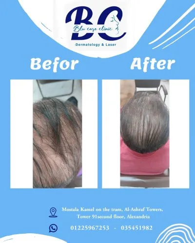 عيادة بلو كير للجلدية والتجميل والليزر  Blu Care Clinic