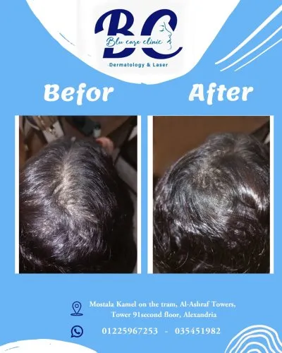 عيادة بلو كير للجلدية والتجميل والليزر  Blu Care Clinic