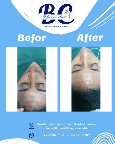 عيادة بلو كير للجلدية والتجميل والليزر  Blu Care Clinic