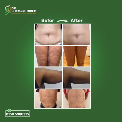 دكتورة شيماء حكيم اخصائى التغذية العلاجية و الصحة العامة