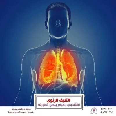 الأستاذ الدكتور اشرف مختار مدكور دكتوراه فى الأمراض الصدرية