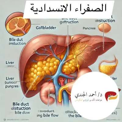 استاذ دكتور احمد الجندى لجراحات أورام وزراعة الكبد