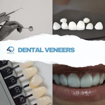 مركز فور دنتل لطب الأسنان