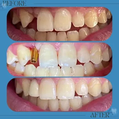 مركز فور دنتل لطب الأسنان