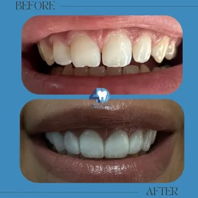 مركز فور دنتل لطب الأسنان