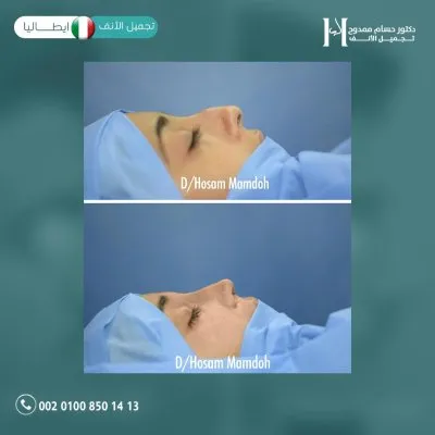 دكتور حسام ممدوح استشاري تجميل الانف