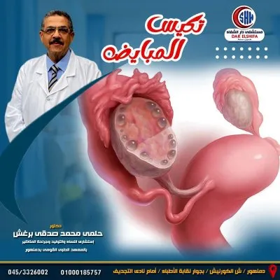 دكتور حلمي محمد برغش استشاري نساء و توليد و جراحة مناظير نسائية