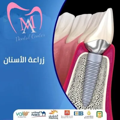 دكتور محمد مجدى صالح أخصائى طب الأسنان