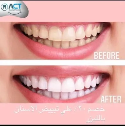 المركز الأمريكي د عبدالله كامل استشاري جراحات تجميل و زراعة الاسنان
