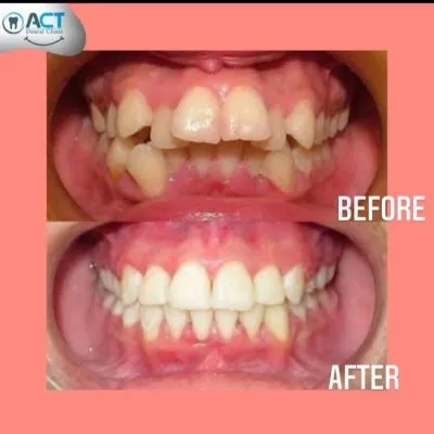 المركز الأمريكي د عبدالله كامل استشاري جراحات تجميل و زراعة الاسنان