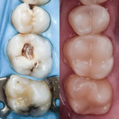 المركز الأمريكي د عبدالله كامل استشاري جراحات تجميل و زراعة الاسنان