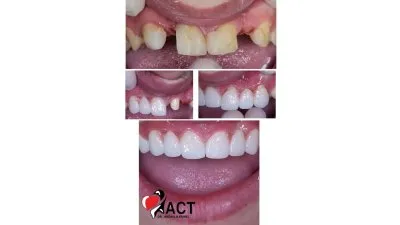 المركز الأمريكي د عبدالله كامل استشاري جراحات تجميل و زراعة الاسنان