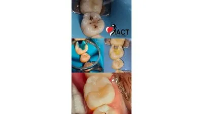 المركز الأمريكي د عبدالله كامل استشاري جراحات تجميل و زراعة الاسنان