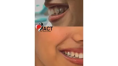 المركز الأمريكي د عبدالله كامل استشاري جراحات تجميل و زراعة الاسنان