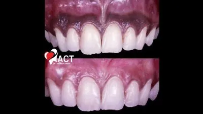 المركز الأمريكي د عبدالله كامل استشاري جراحات تجميل و زراعة الاسنان