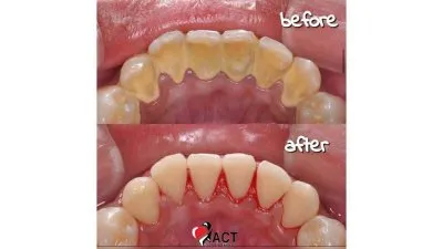 المركز الأمريكي د عبدالله كامل استشاري جراحات تجميل و زراعة الاسنان