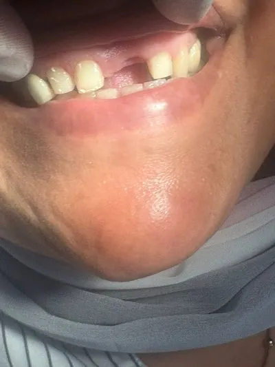 دكتور محمد نبيل بسيونى لطب الأسنان