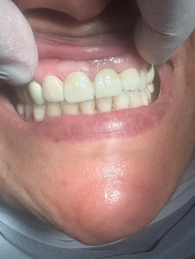 دكتور محمد نبيل بسيونى لطب الأسنان