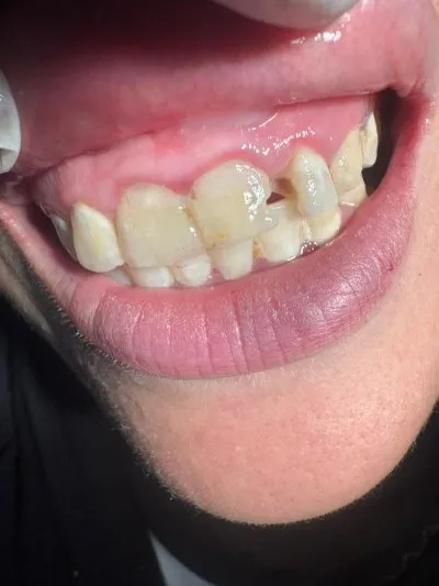 دكتور محمد نبيل بسيونى لطب الأسنان