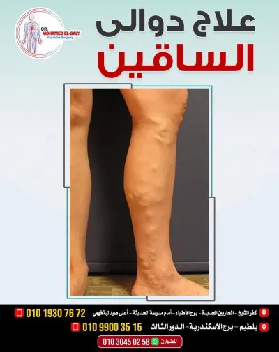 دكتور محمد الجالي اخصائي جراحة الاوعية الدموية والقدم السكري