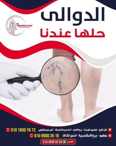 دكتور محمد الجالي اخصائي جراحة الاوعية الدموية والقدم السكري