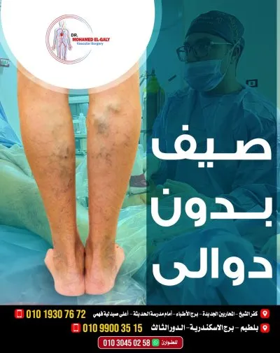 دكتور محمد الجالي اخصائي جراحة الاوعية الدموية والقدم السكري